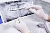 Wypadki stomatologiczne - częsty powód poważnych obrażeń jamy ustnej